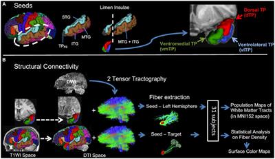 Structural connectivity of cytoarchitectonically distinct human left temporal pole subregions: a diffusion MRI tractography study